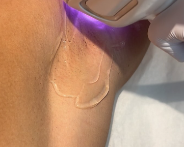 Provider Image